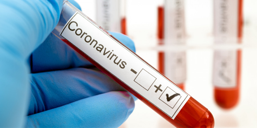 De interes public! Ce trebuie să știți despre coronavirus?